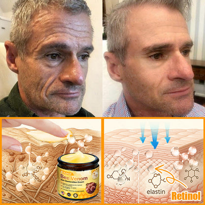 Made and Shipped from USA 🎇 VLSVLS® Bee Venom Skin Restoration Cream 🔥 LAST DAY 80% OFF🔅