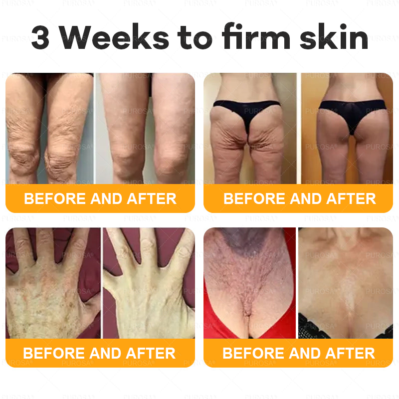 Made and Shipped from USA 🎇 VLSVLS® Bee Venom Skin Restoration Cream 🔥 LAST DAY 80% OFF🔅