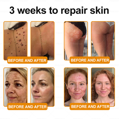 Made and Shipped from USA 🎇 VLSVLS® Bee Venom Skin Restoration Cream 🔥 LAST DAY 80% OFF🔅